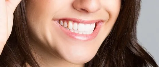 33231 at home teeth whitening