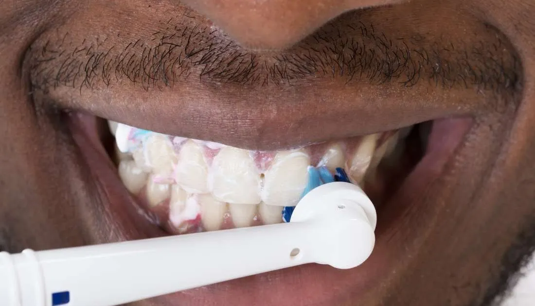 33231 professional teeth whitening