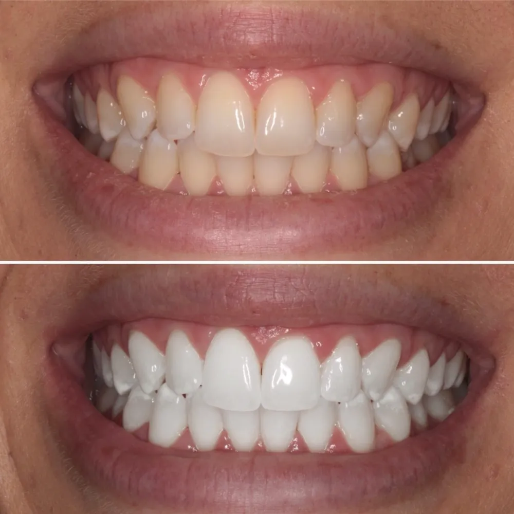 33235 healthy teeth diet