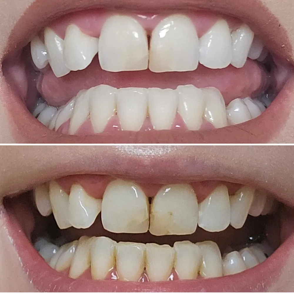 33235 whitening toothpaste