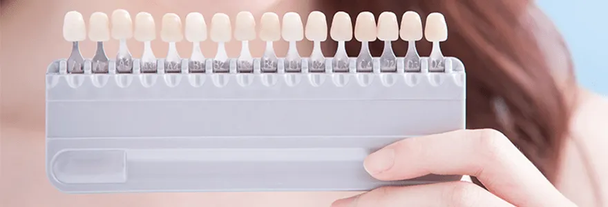 33243 teeth whitening cost comparison