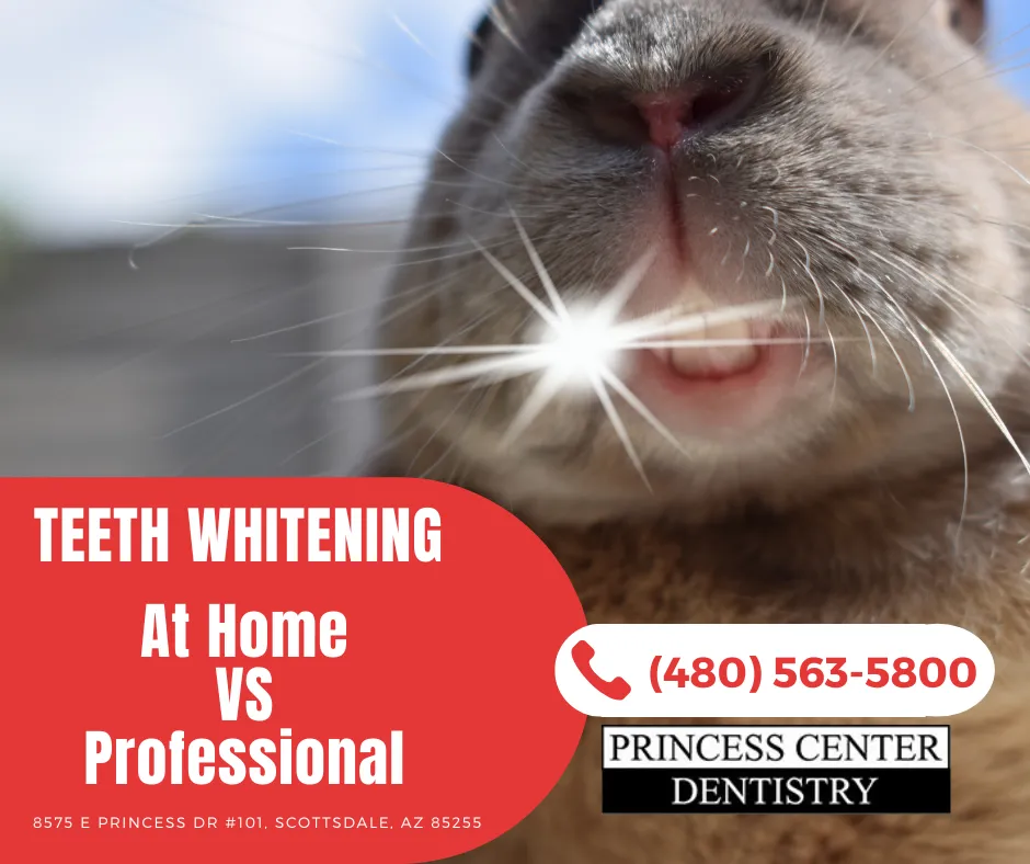 33243 types of teeth whitening kits