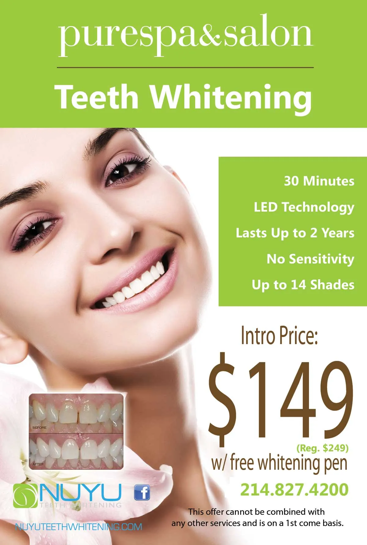 33251 teeth whitening pasadena 1