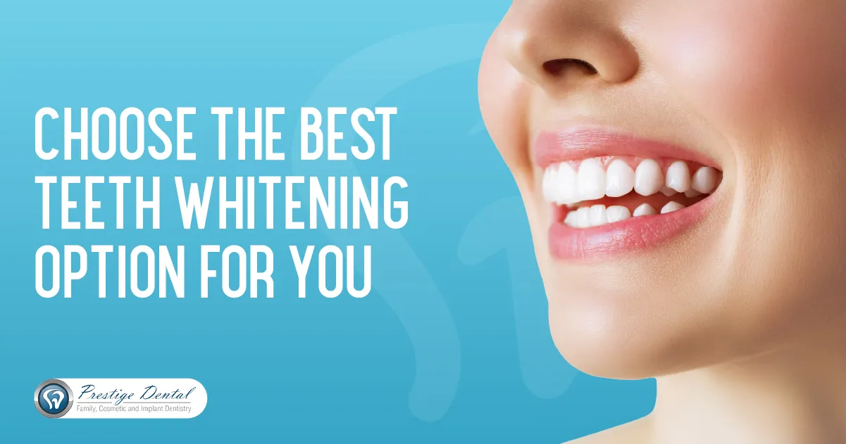 33251 teeth whitening pasadena 2