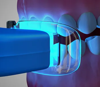 33251 teeth whitening pasadena 5