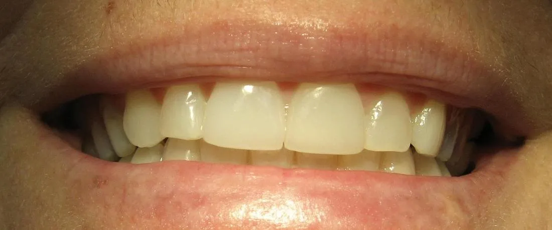 33262 regular dental checkups