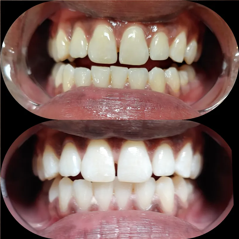 33264 new orleans dentist consultation