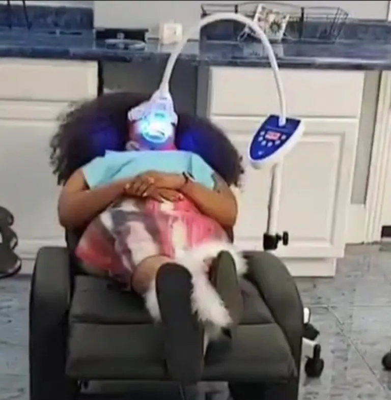 33264 teeth whitening in office