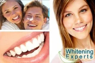 33307 teeth whitening birmingham al 6