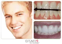 33308 star white teeth whitening oral hygiene