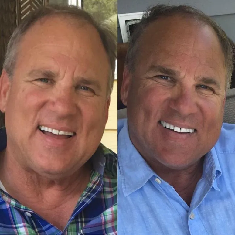 33315 teeth whitening customer reviews