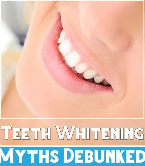 33317 professional teeth whitening image6