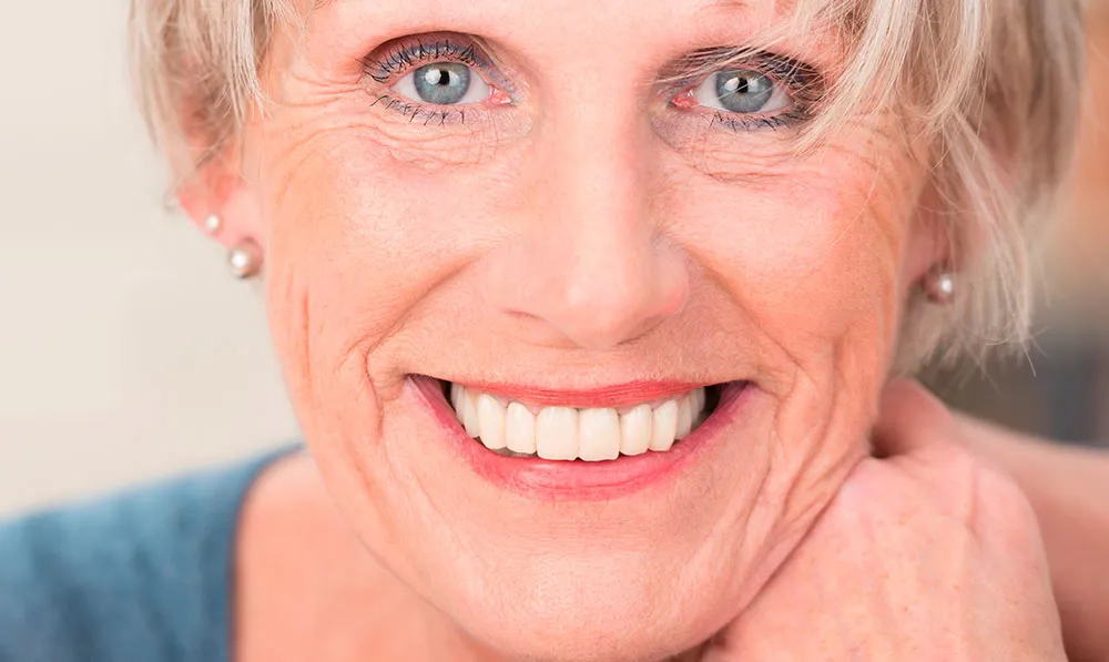 33321 teeth whitening results