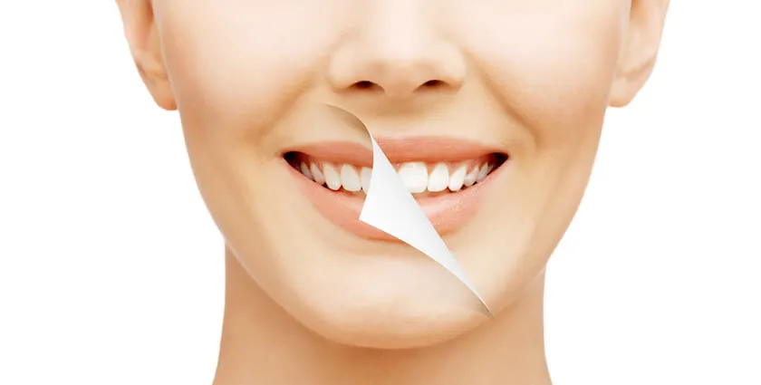 33324 teeth whitening science