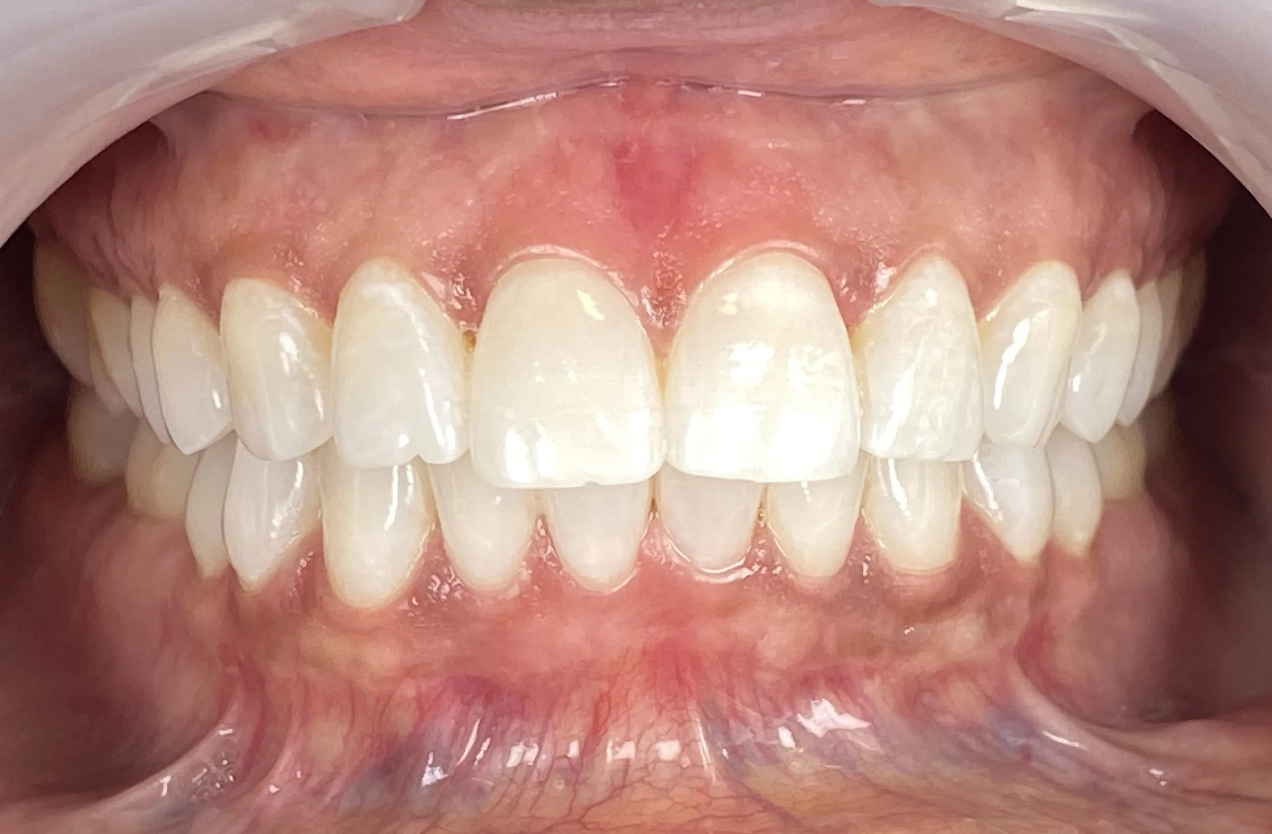 33327 maintaining bright smile