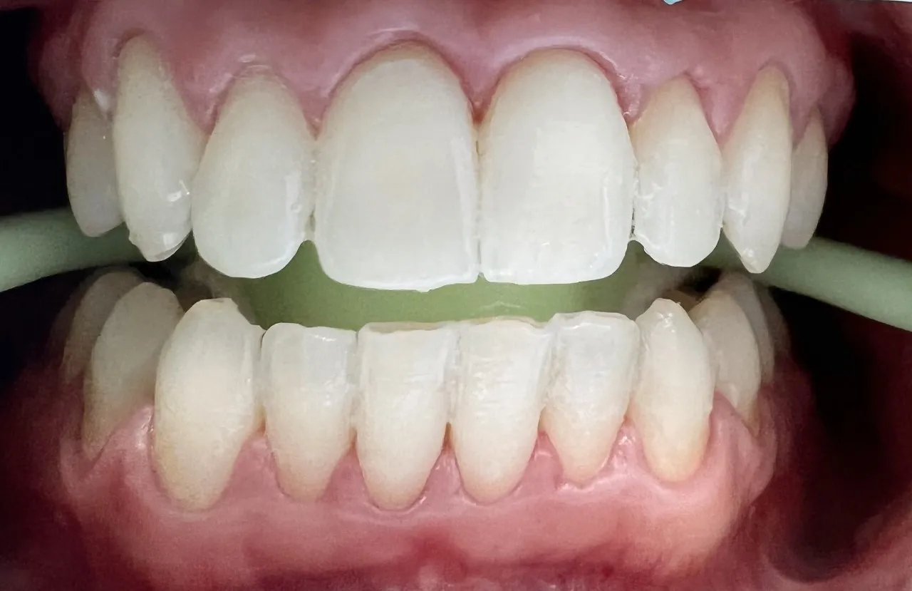 33334 dentist consultation