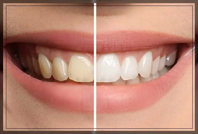 33334 oral hygiene tips