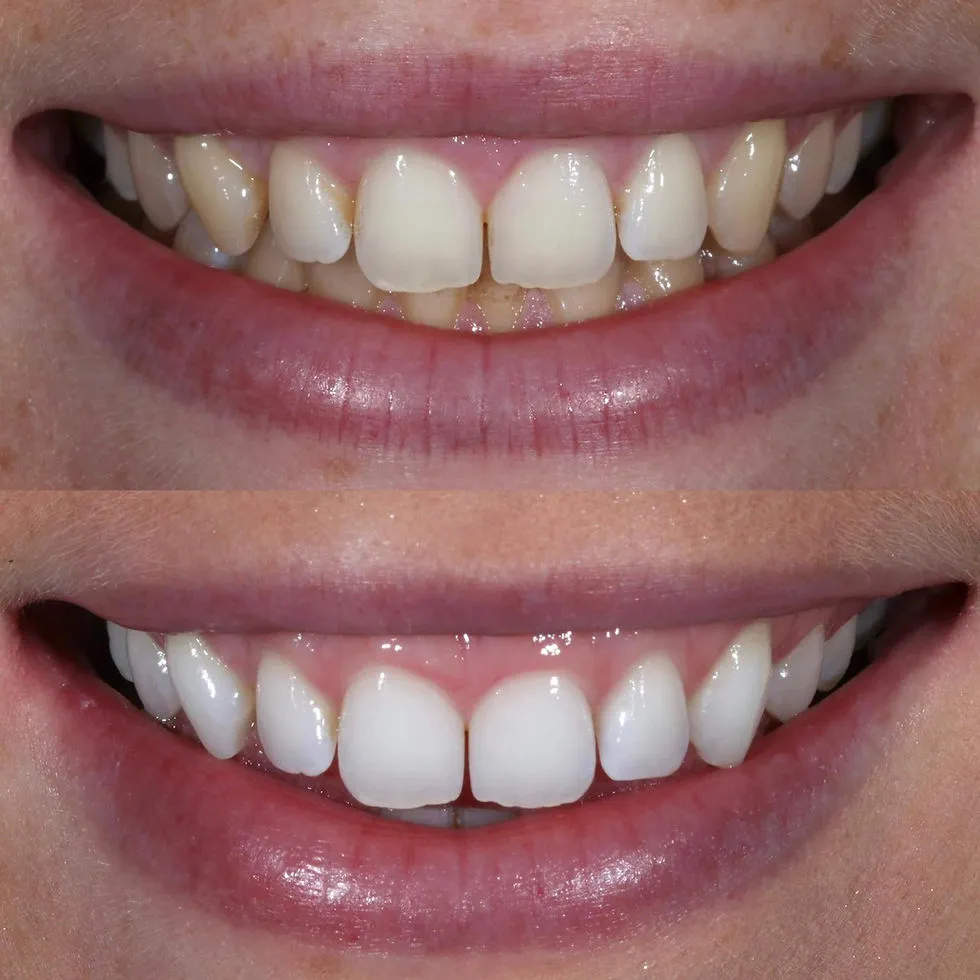 33334 staining foods