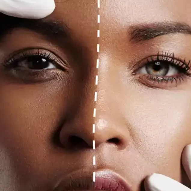 33336 chemical peels skin