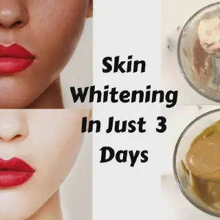 /img/33346-skin-whitening-results.webp