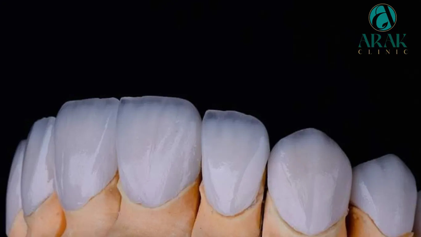 33347 zoom teeth whitening uk 4