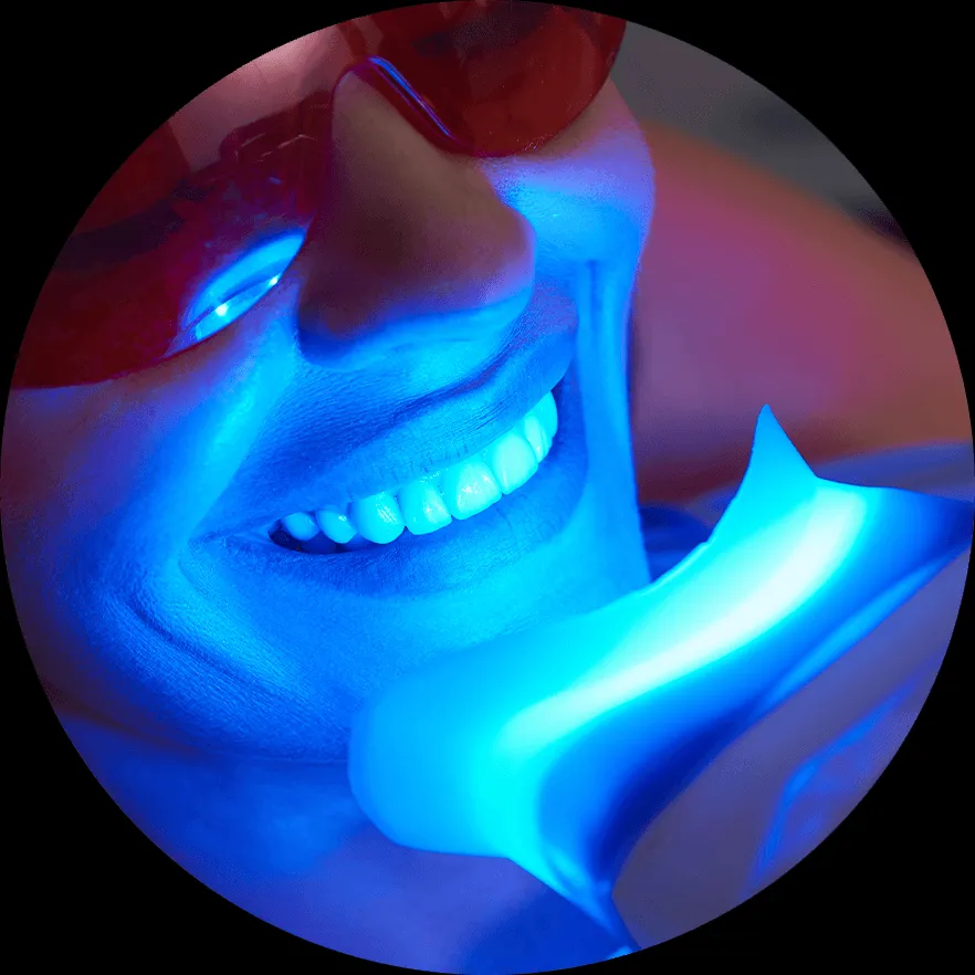 33347 zoom teeth whitening uk 5