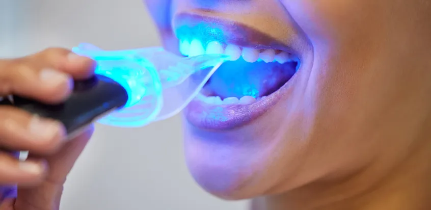33347 zoom teeth whitening uk 6