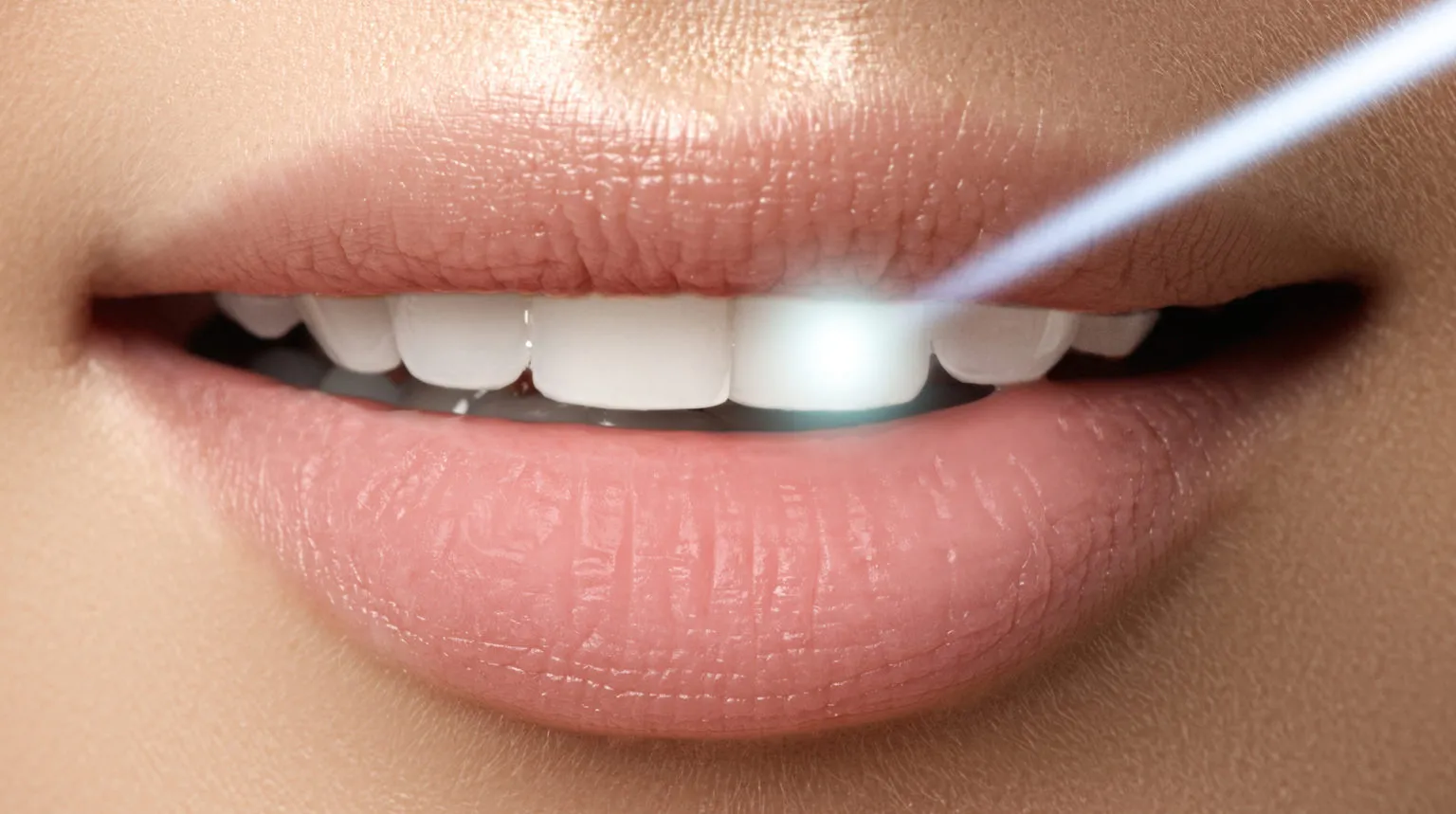 33362 laser teeth whitening 2