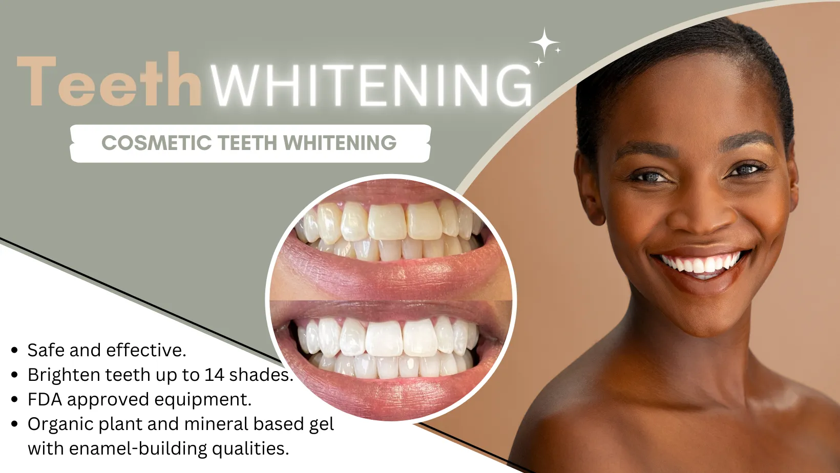 33368 professional teeth whitening