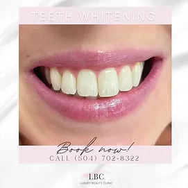 33371 professional teeth whitening