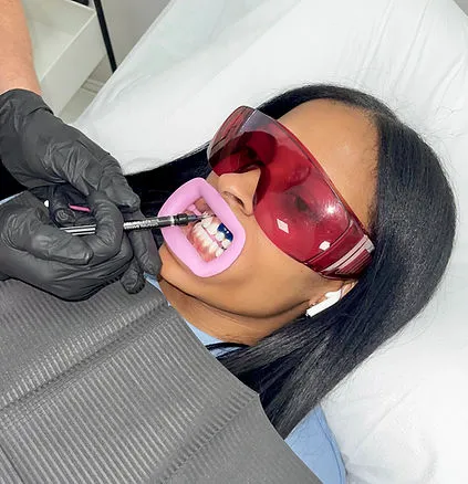 33371 teeth discoloration causes