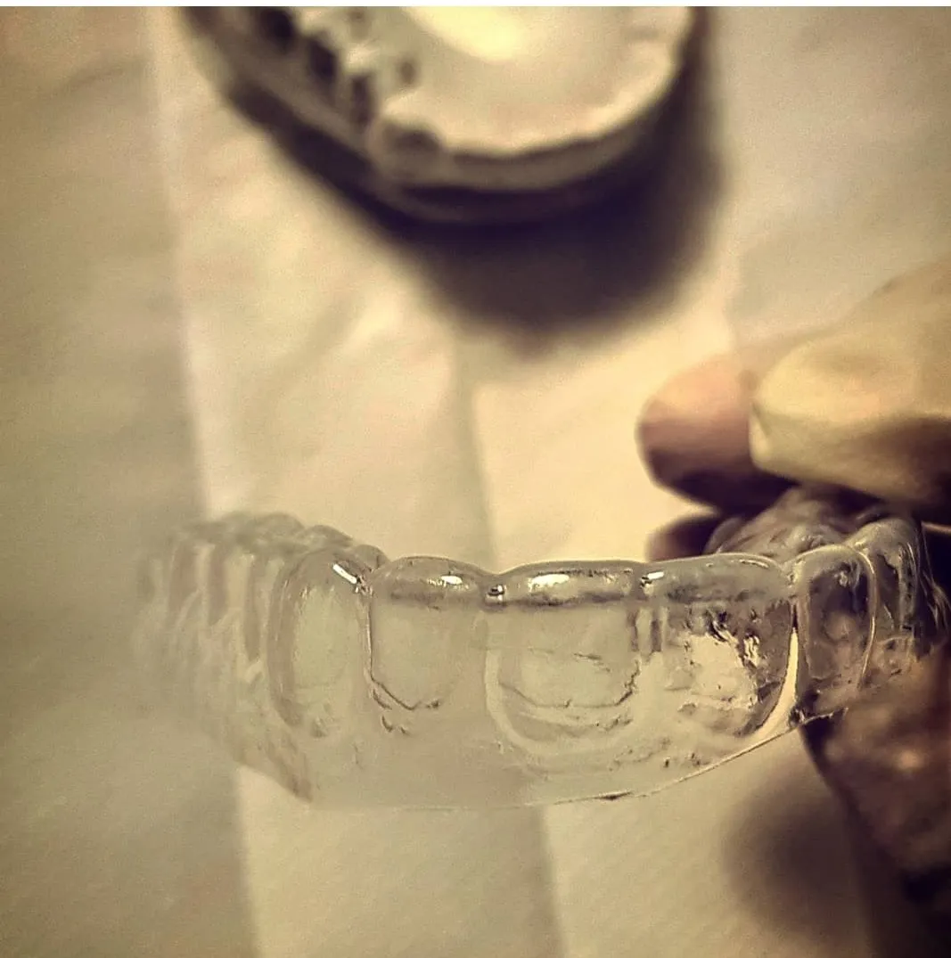 33382 pearline whitening trays uk confidence