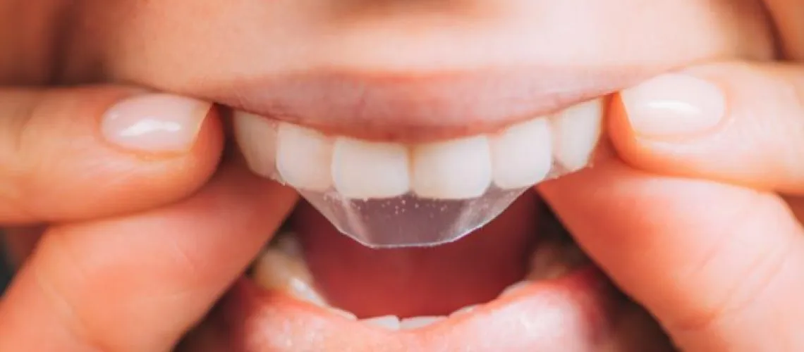 33395 whitening strips tooth pain 4