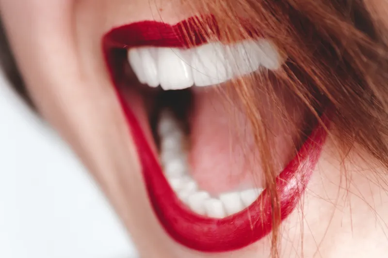 33395 whitening strips tooth pain 5