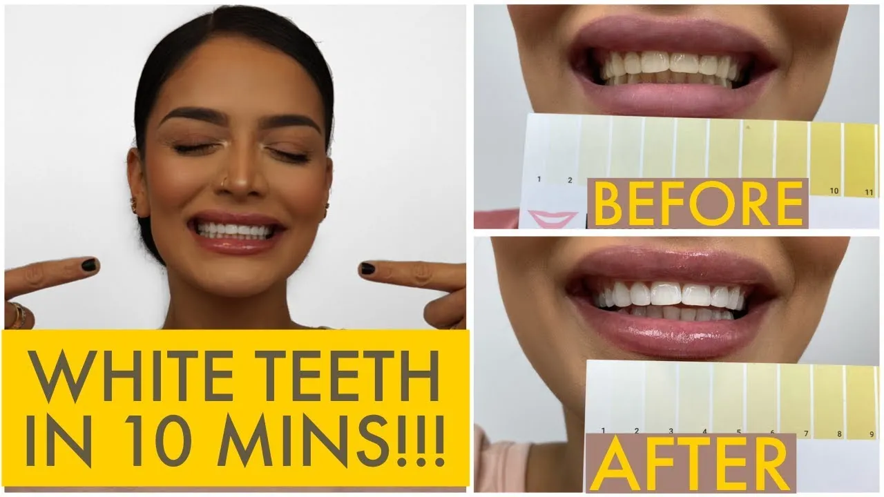 33402 britesmile before after