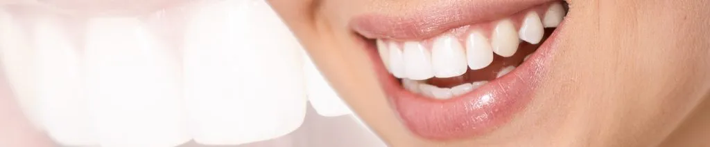 33402 teeth whitening process