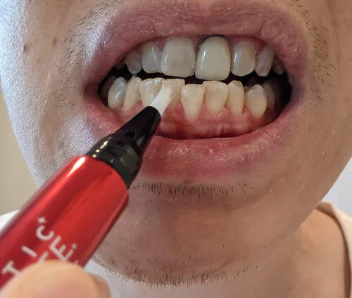 33418 hydrogen peroxide usage