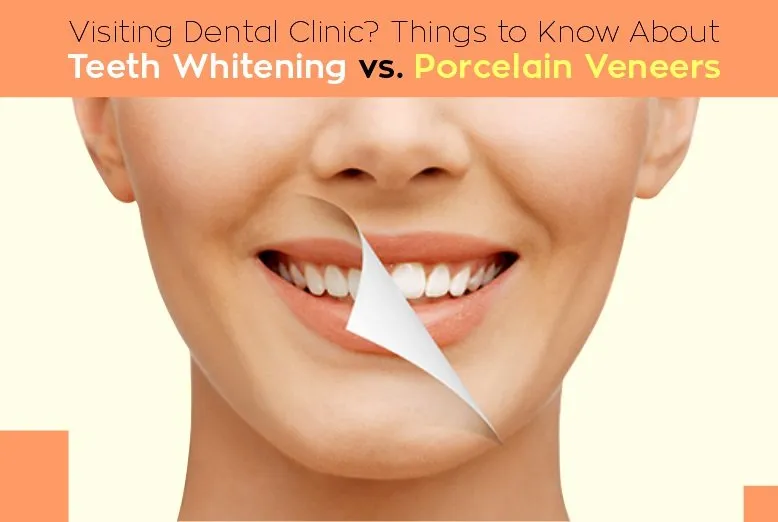 33426 porcelain veneers