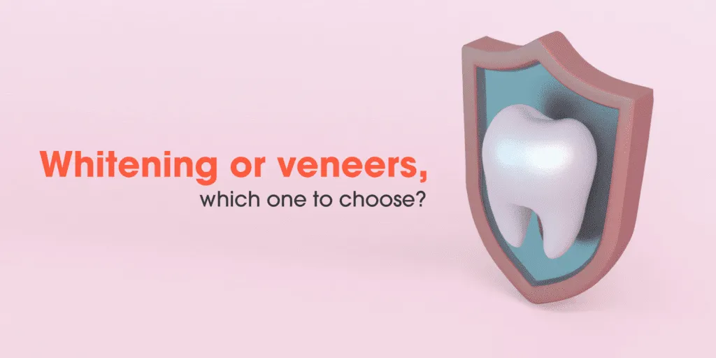 33426 teeth whitening vs veneers main