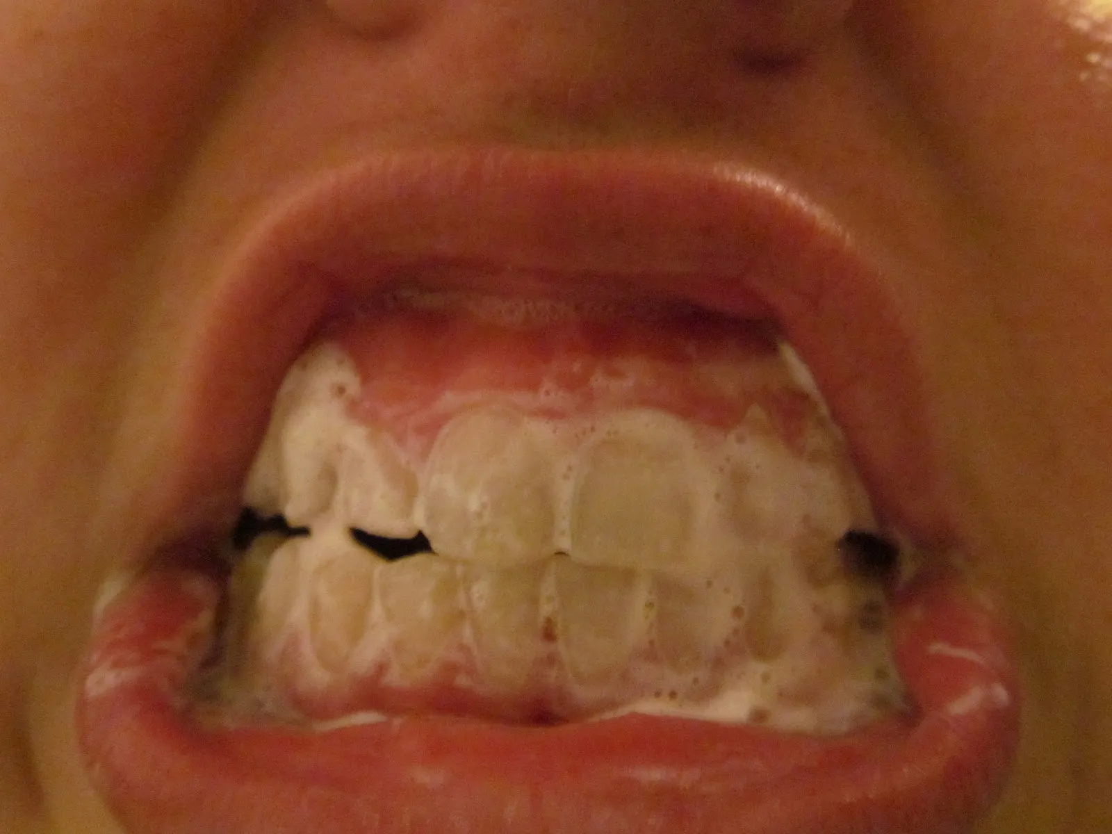 33431 natural tooth shade