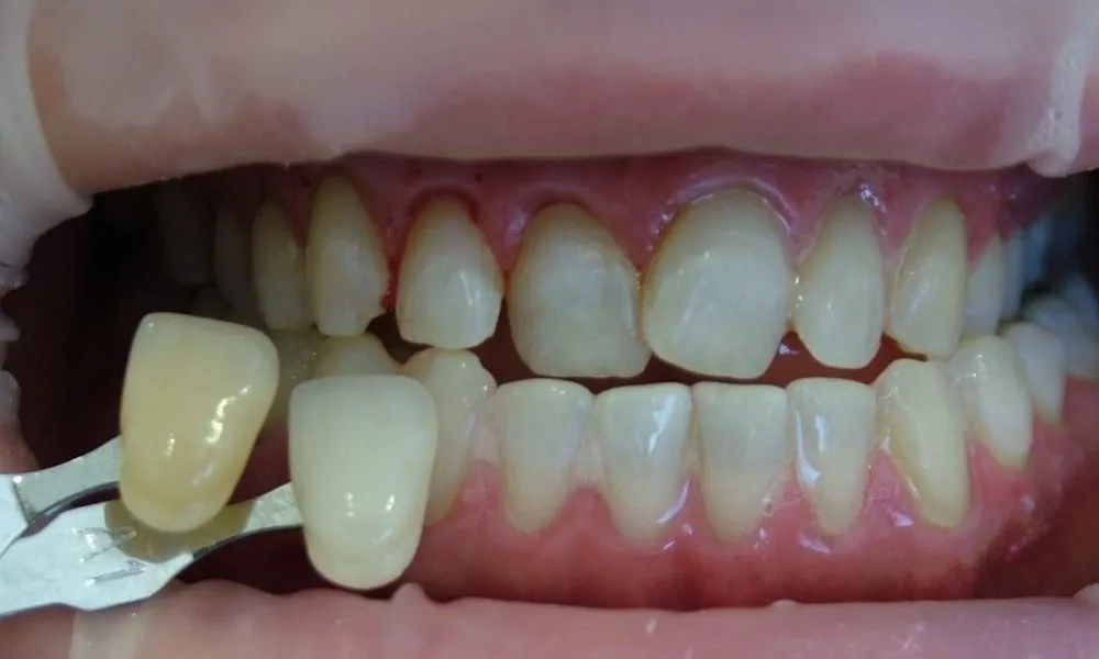 33439 healthy smile adelaide