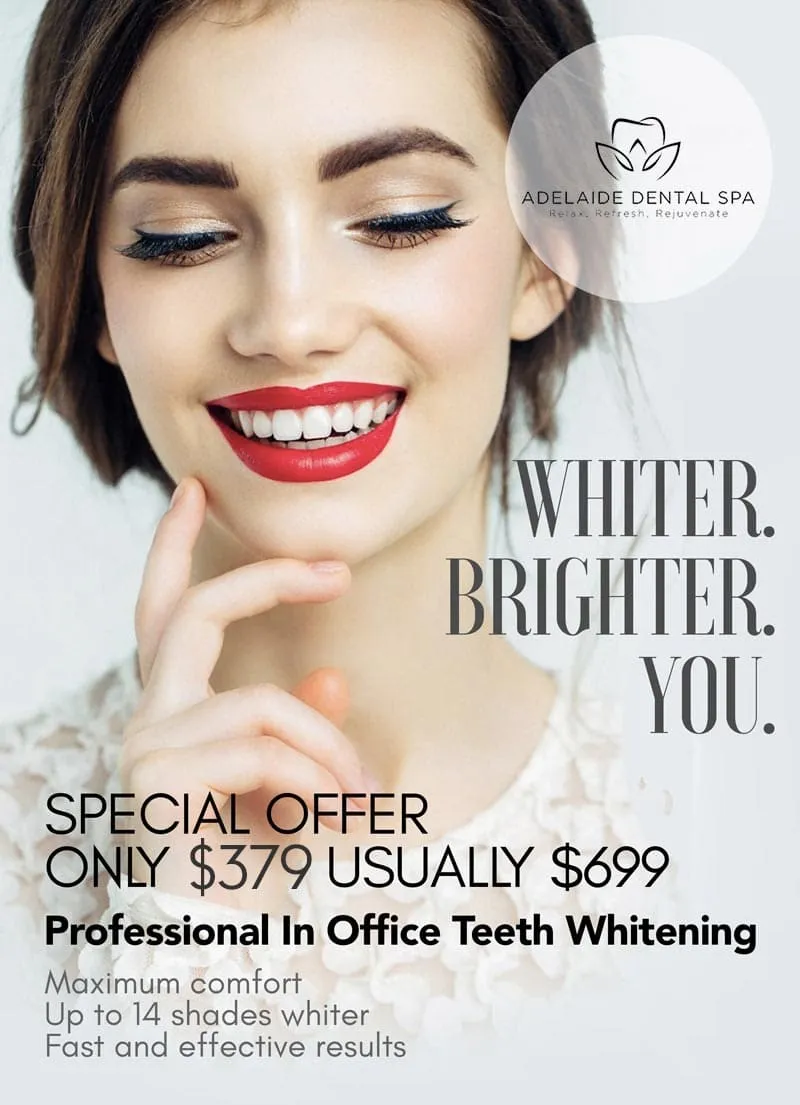 33439 teeth whitening comparison