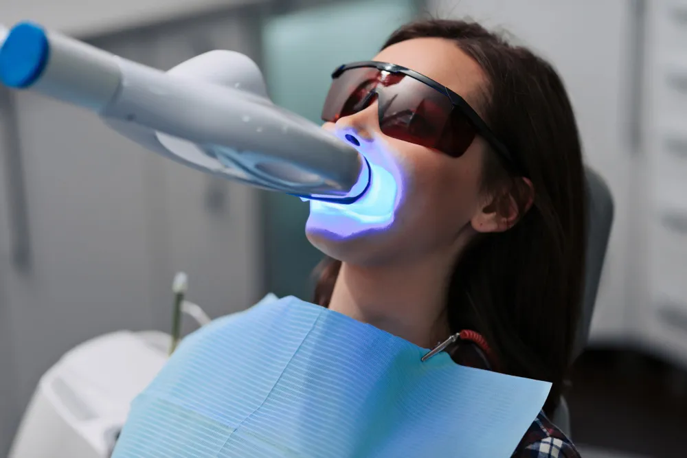 33463 teeth whitening trays