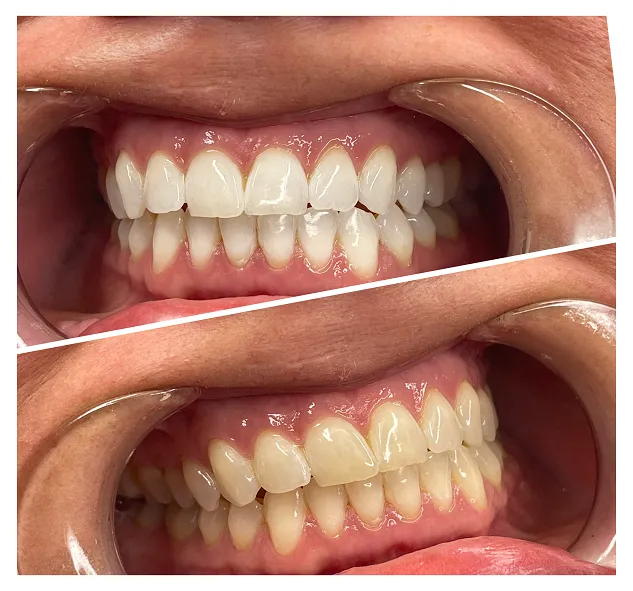 33470 oral hygiene techniques