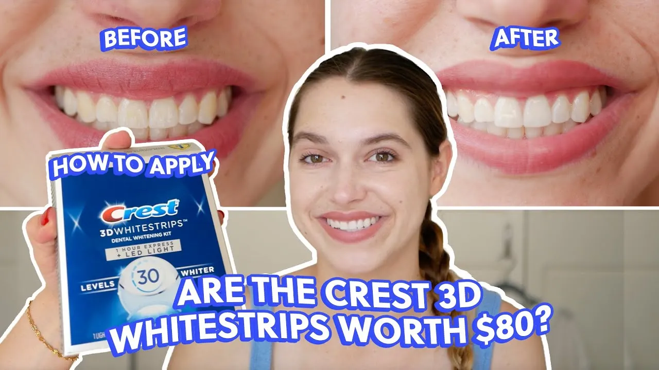 33474 teeth whitening results