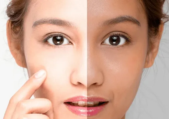 33479 laser skin treatment