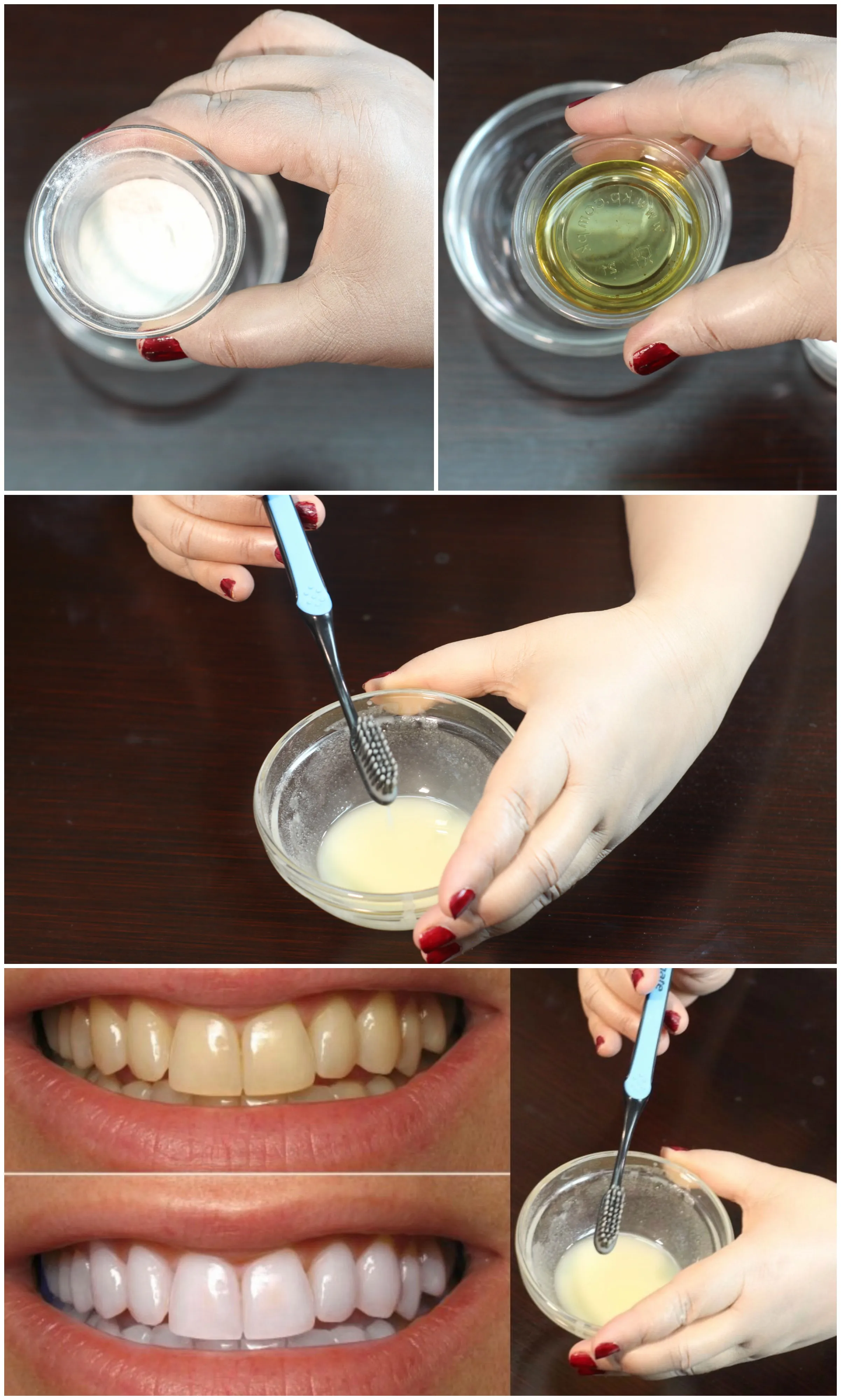 33481 strawberry teeth whitening