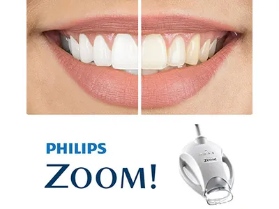 /img/33486-zoom-whitening-miami-aftercare.webp