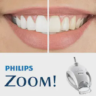 /img/33486-zoom-whitening-miami-aftercare.webp