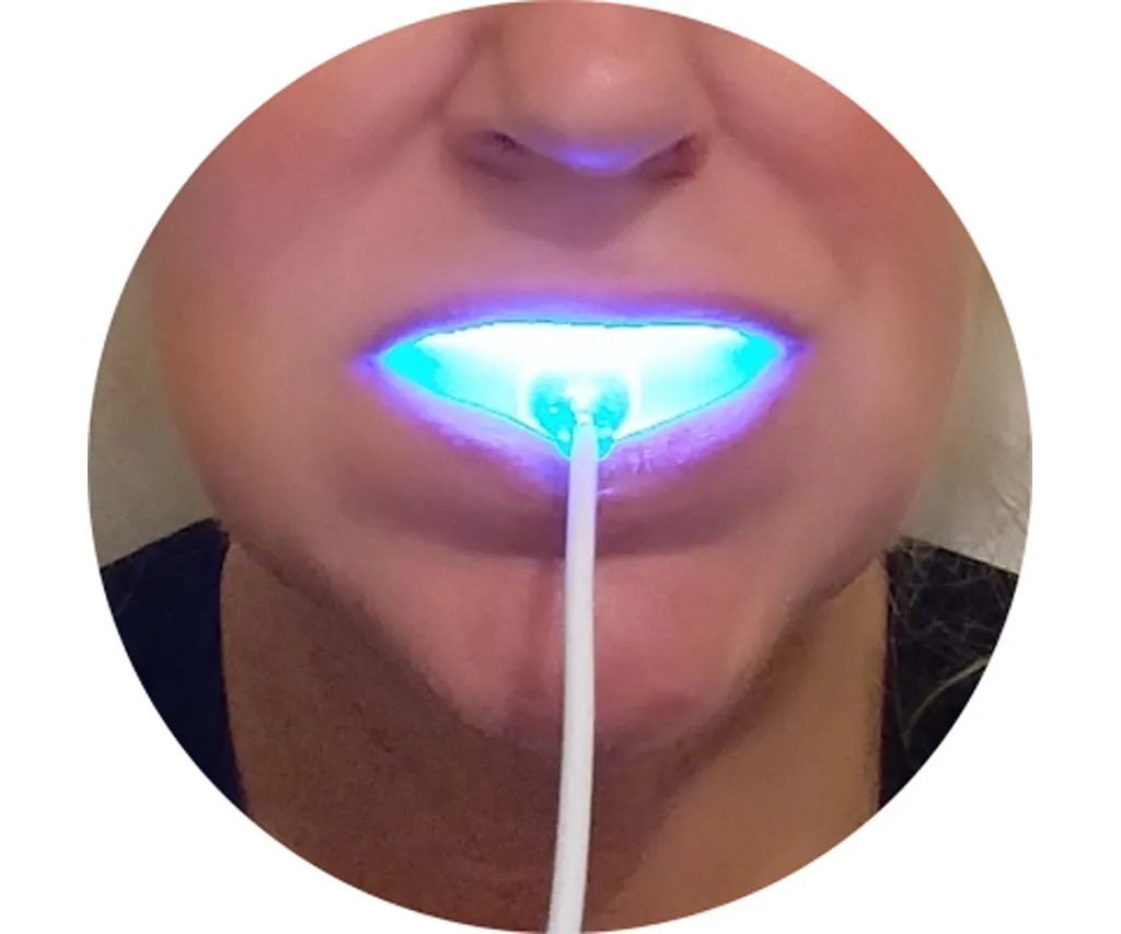 33490 safe teeth whitening options